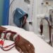 Bawumia announces free kidney dialysis for all NHIS patients from Dec 1