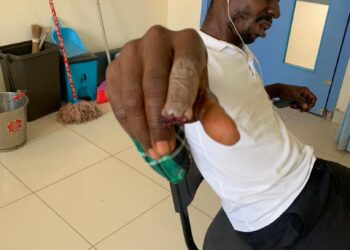 Tension in Twifo Atimorkwa NPP as Constituency Organizer Bites Off Polling Station Secretary’s Finger